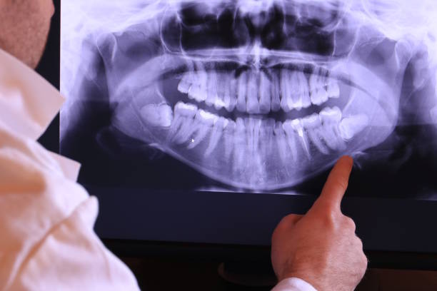 Best Emergency Broken Tooth Repair in Richnd, MO