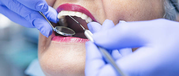 Best Emergency Tooth Extraction in Richnd, MO